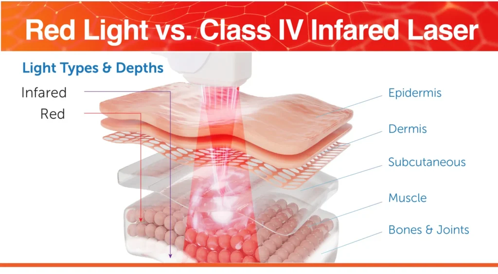 Red light therapy