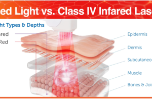 The Benefits Of Transcranial Red Light Therapy