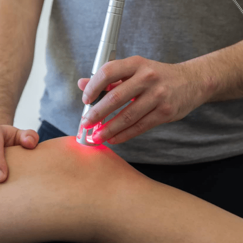 A person getting a laser on their leg