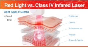 Red light vs. Class IV Infared Laser