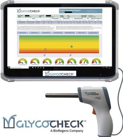 Glycocheck